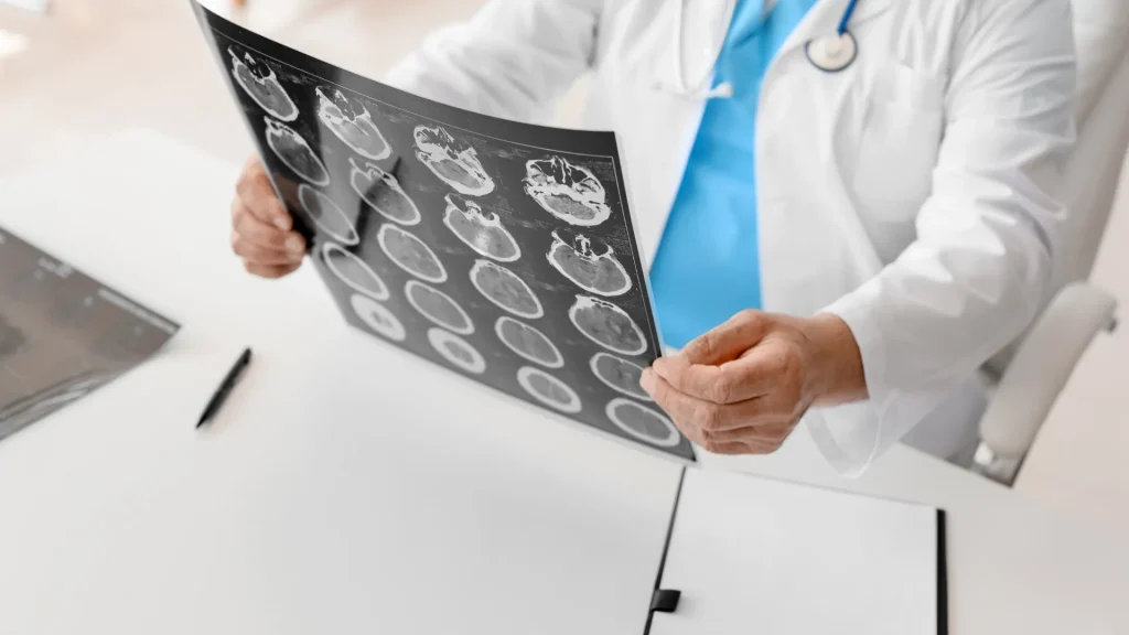 Doctor examining a brain scan X-ray image.
