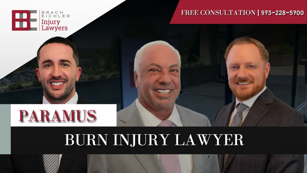 Burn Injury Lawyer in Paramus Image